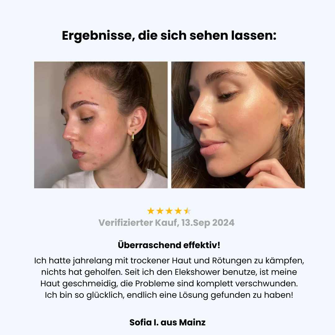 Elekshower Vitamin-C Duschkopf filtert Chlor & Kalk für weiches Duschwasser